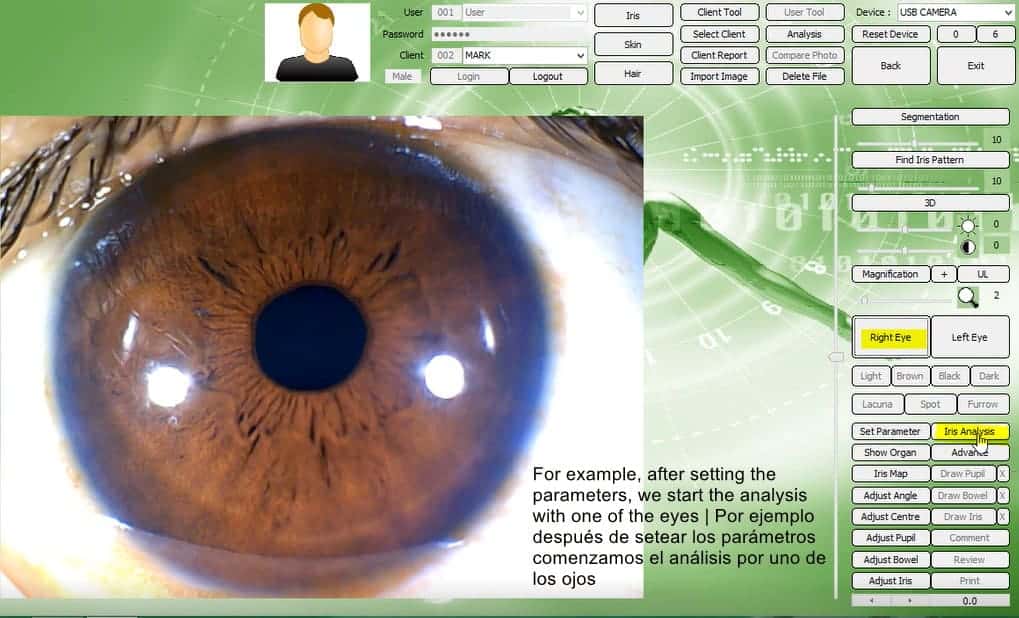 iriscope iridology 5MP analisis del iris