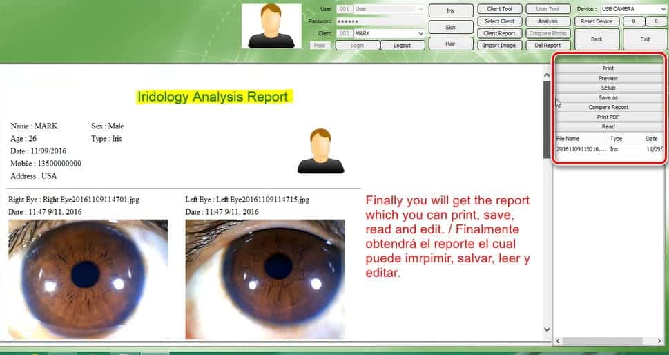 iridology report